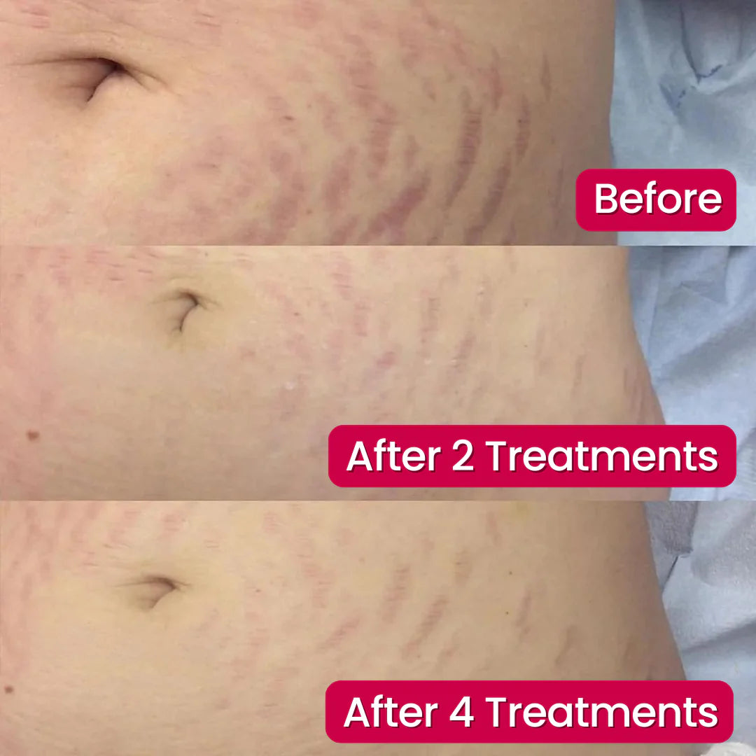 SivGlo™ - Restore Confident Skin