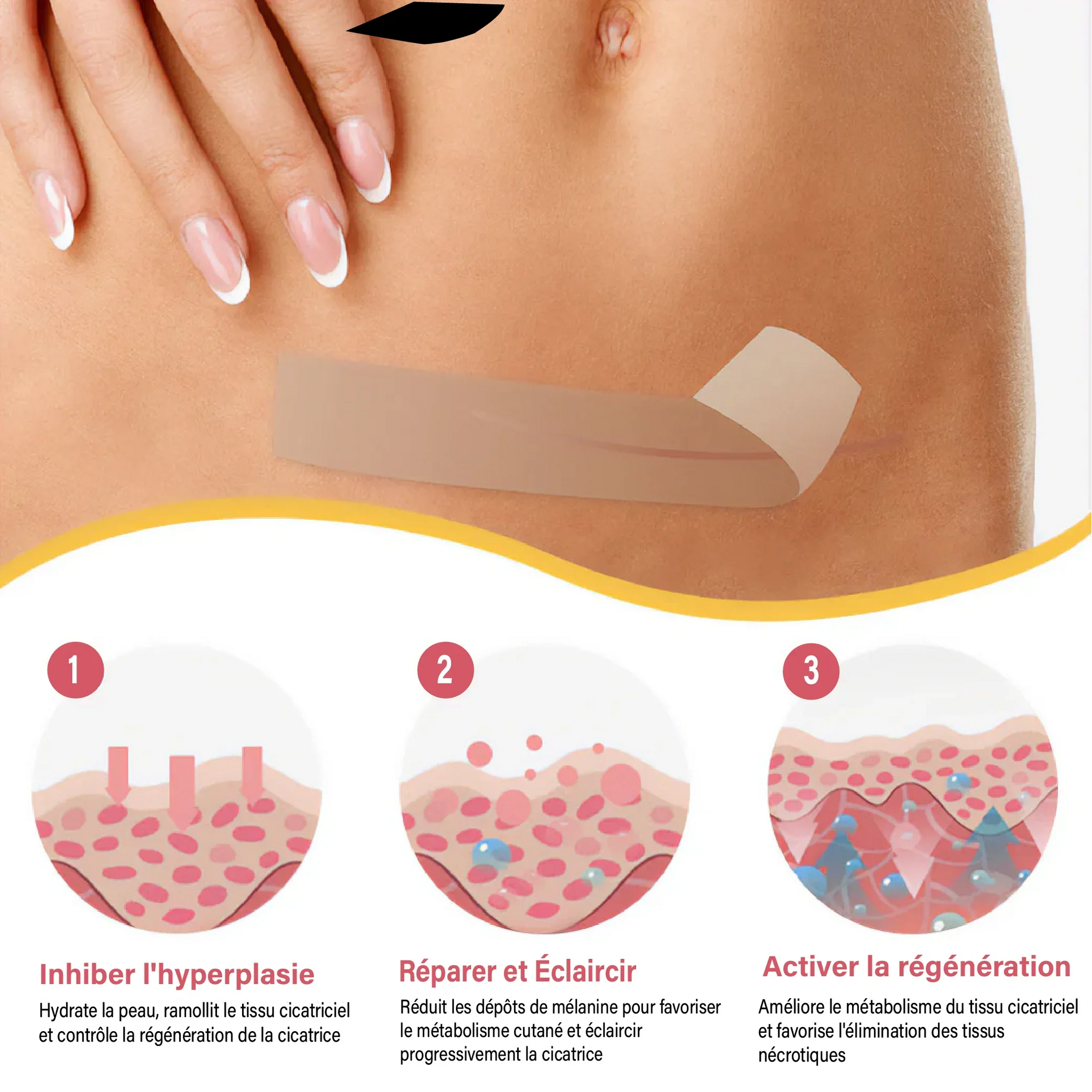 Le mensonge des crèmes anti-cicatrices : pourquoi 99 % des traitements ne fonctionnent pas (et celui-ci, enfin, oui !)