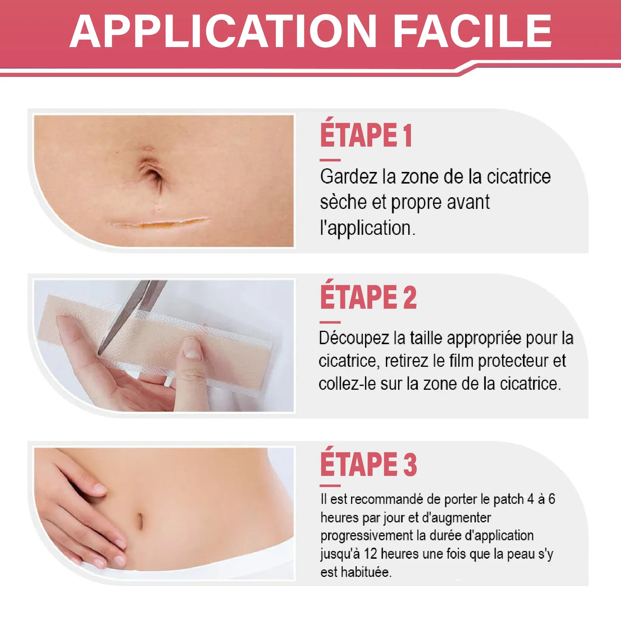 Le mensonge des crèmes anti-cicatrices : pourquoi 99 % des traitements ne fonctionnent pas (et celui-ci, enfin, oui !)