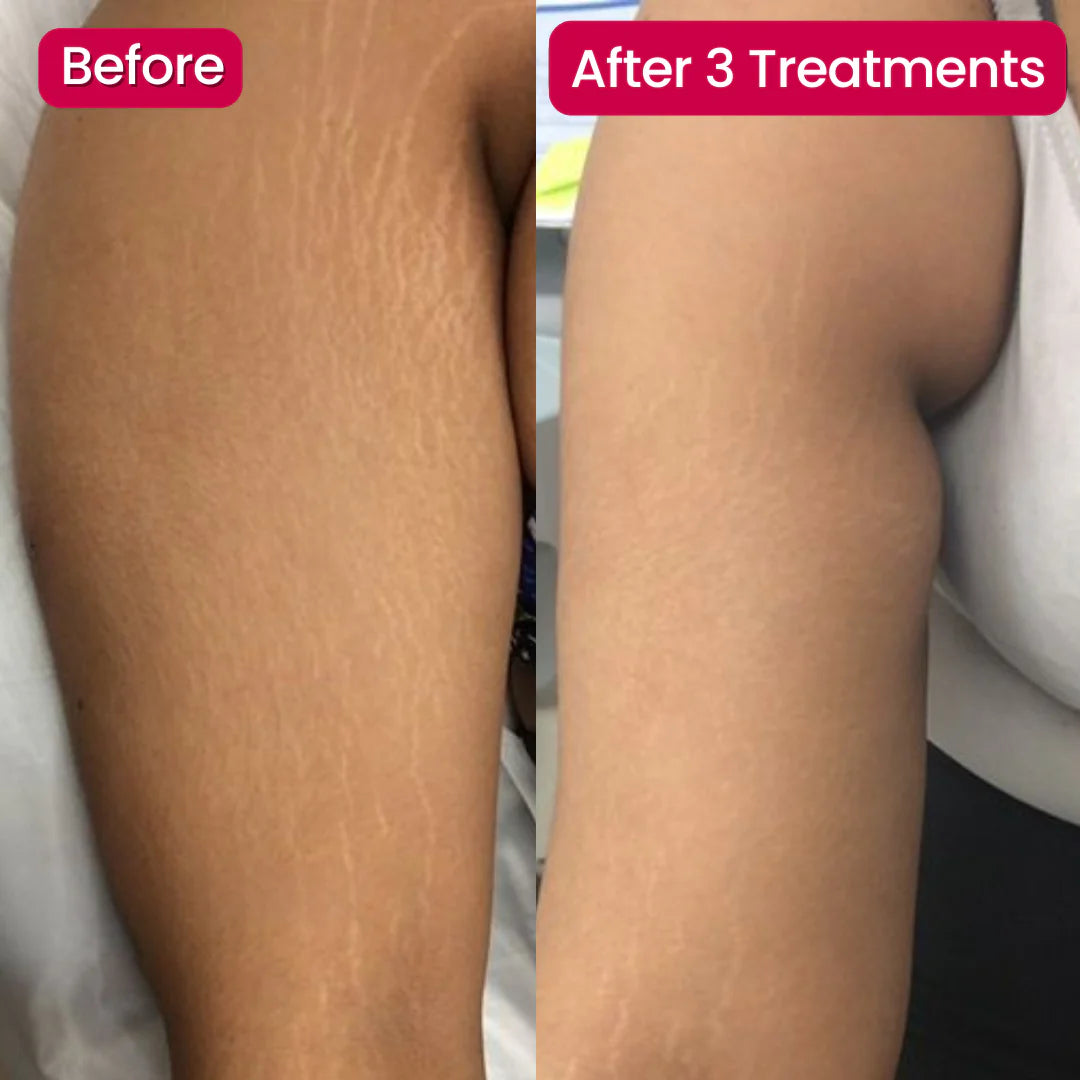 SivGlo™ - Restore Confident Skin