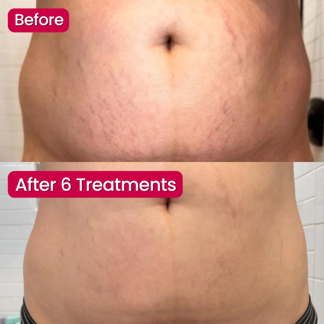 SivGlo™ - Restore Confident Skin