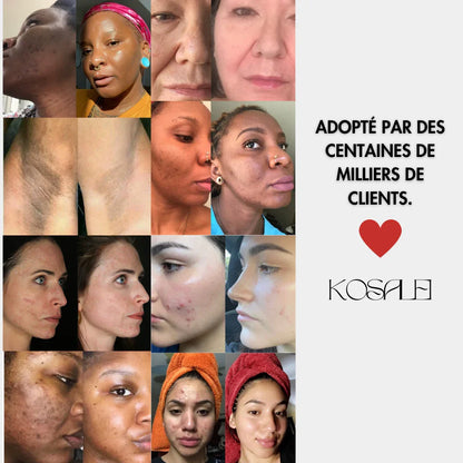 HyperFade ™ - dischi di carnagione anti -taco e luminosi in 21 giorni