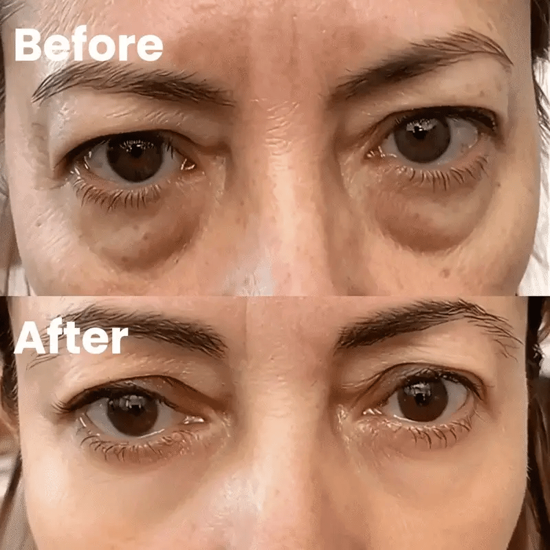 Before after