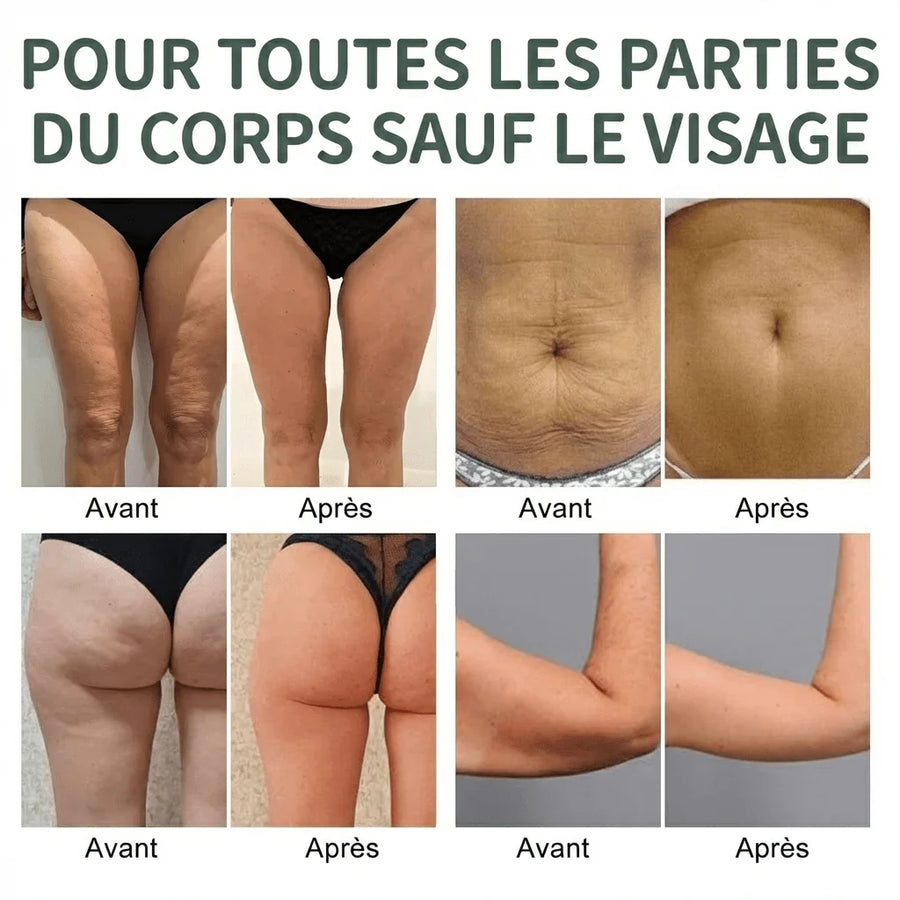 tonicité