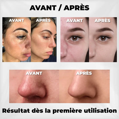 Éclora™ Peel Shot — Exfoliant Coréen au Riz